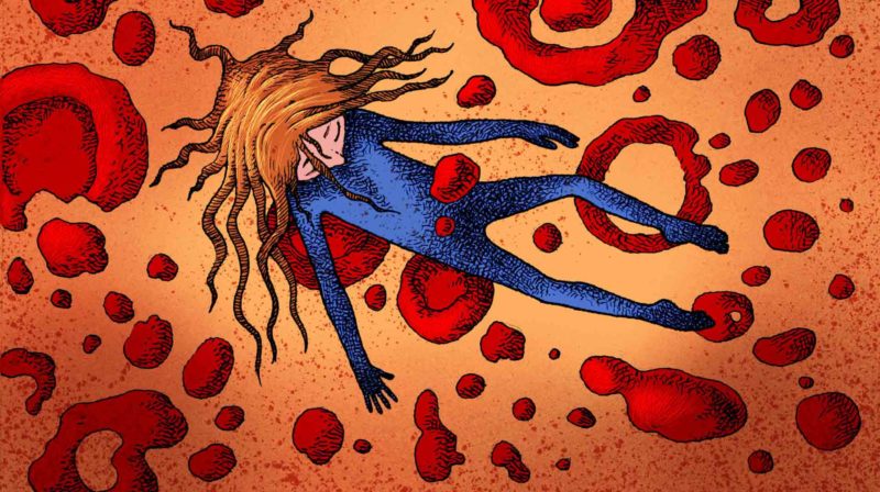 Anemia hemolítica - Ilustración: Walther Sorg
